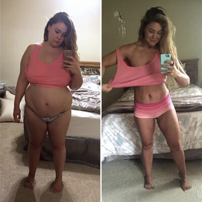 Vorher-Nachher Ergebnis 2