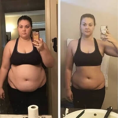 Vorher-Nachher Ergebnis 3