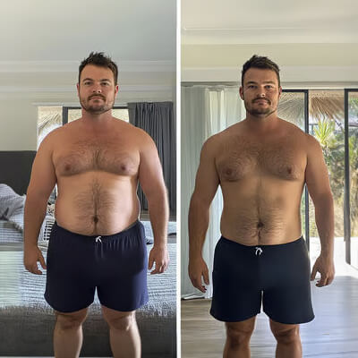 Vorher-Nachher Ergebnis 4